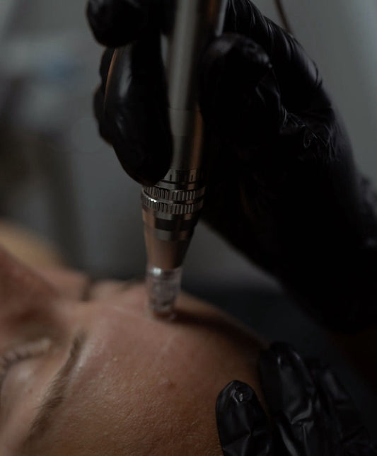 Microneedling
